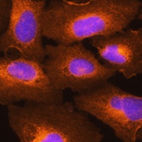 Anti-HLA-C Antibody
