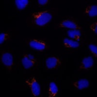 Anti-ETHE1 Antibody