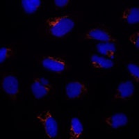 ETHE1 antibody