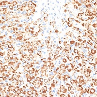 Anti-KLHL9 Antibody