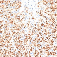 KLHL9 antibody