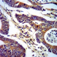 Anti-LOXL1 Antibody