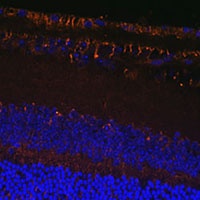 Anti-LOXL1 Antibody