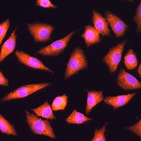 Anti-HINT1 Antibody