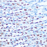 SLC11A2 antibody