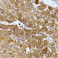 Anti-Septin 4 Antibody
