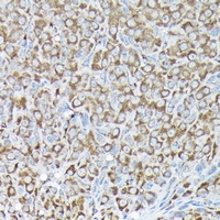 RPS15A antibody