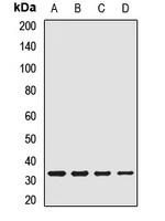 CTP Antibody