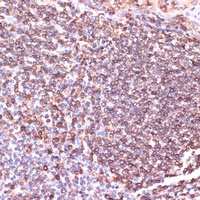 Anti-TPD52 Antibody