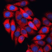 Anti-EIF3B Antibody