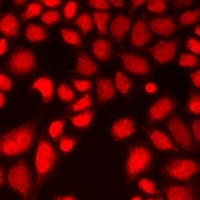 Anti-14-3-3 sigma Antibody