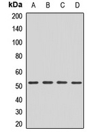 FADS2 Rabbit Polyclonal Antibody
