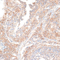 Anti-KIF14 Antibody