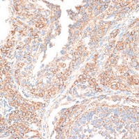 KIF14 antibody