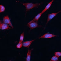 Anti-DDAH1 Antibody
