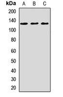 CACNA2D3 Antibody