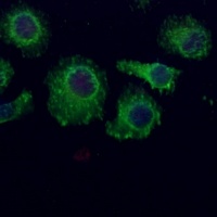 Anti-STRAD alpha Antibody