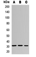 MMACHC Antibody