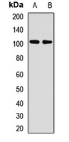ZC3H14 Antibody