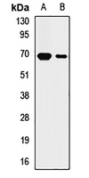 Cytokeratin 2 Rabbit Polyclonal Antibody