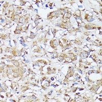 Anti-MTHFD2 Antibody