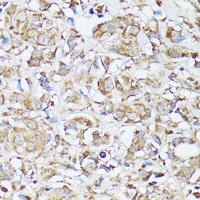 MTHFD2 antibody