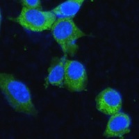 Anti-MTHFD2 Antibody