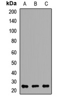 RAB27B Rabbit Polyclonal Antibody