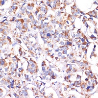 Anti-STOML2 Antibody