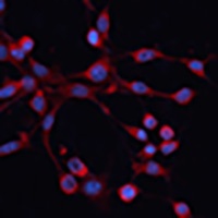 Anti-GNA14 Antibody