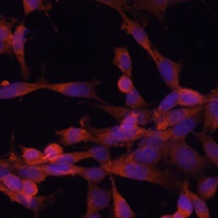 Anti-UBE2G2 Antibody
