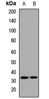 TLT1 Rabbit Polyclonal Antibody