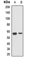 ERGIC-53 Rabbit Polyclonal Antibody