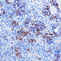 TYMS antibody