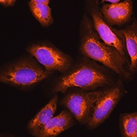 Anti-EXOSC2 Antibody