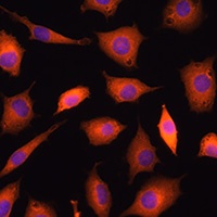 Anti-PGDH3 Antibody