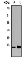 TRAPPC2 Rabbit Polyclonal Antibody
