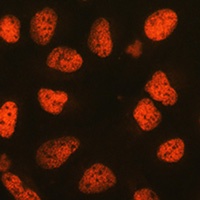 P4HA1 antibody