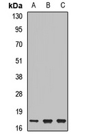 UBE2N Rabbit Polyclonal Antibody