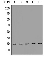 GIPC Rabbit Polyclonal Antibody