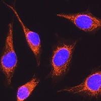 Anti-RCN1 Antibody