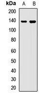 WDR11 Rabbit Polyclonal Antibody