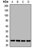 SR- beta Rabbit Polyclonal Antibody