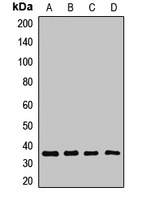 LAPTM4B Rabbit Polyclonal Antibody
