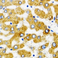 SLC27A2 antibody