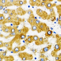 Anti-ACSVL1 Antibody