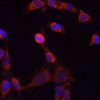 PSMD14 antibody