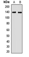 MTMR3 Rabbit Polyclonal Antibody