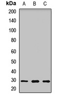 UCK2 Rabbit Polyclonal Antibody