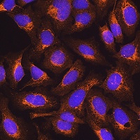 Anti-SDHB Antibody